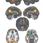 Neural correlates of maintaining one’s political beliefs in the face of counterevidence